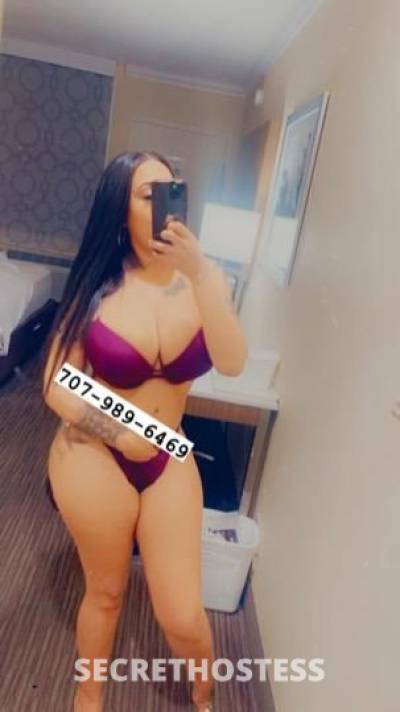 ExoticZoey 27Yrs Old Escort North Bay CA Image - 4