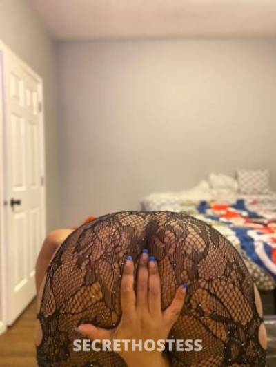 REMEDY 28Yrs Old Escort Chicago IL Image - 5