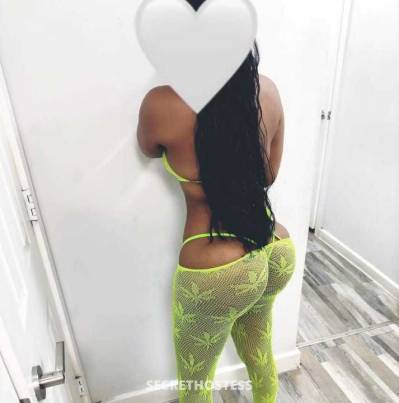 26Yrs Old Escort Bronx NY Image - 1