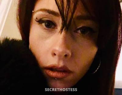 25 Year Old Caucasian Escort Mississauga Redhead Blue eyes - Image 3