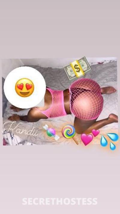 Kandi🍬🍭💦 22Yrs Old Escort Bronx NY Image - 0