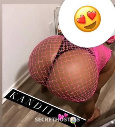 Kandi🍬🍭💦 22Yrs Old Escort Bronx NY Image - 1