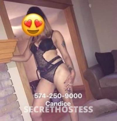 Candice 25Yrs Old Escort South Bend IN Image - 2