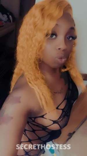 ExoticDoll😘 23Yrs Old Escort Chicago IL Image - 0