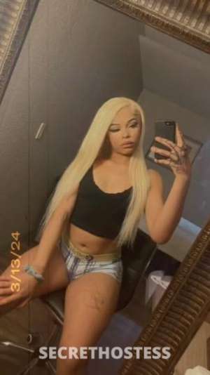 20Yrs Old Escort Dallas TX Image - 1