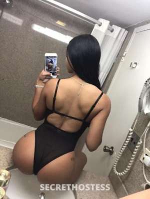 22Yrs Old Escort Westchester NY Image - 1