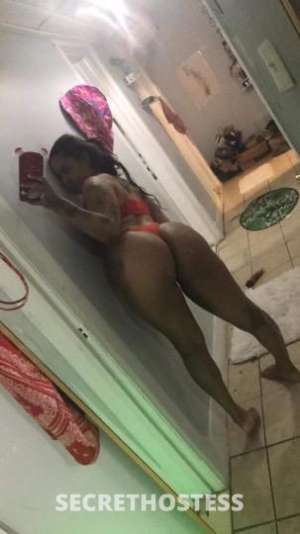 27Yrs Old Escort Westchester NY Image - 1