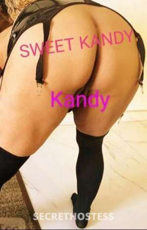 CandyApple 29Yrs Old Escort Toronto Image - 0