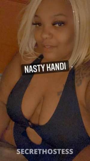 Nasty kandi ready bbw ready to play call me now in Chicago IL