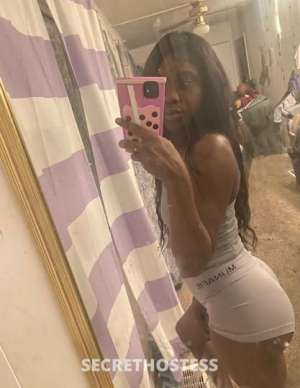 HersheyKiss 21Yrs Old Escort Chicago IL Image - 0