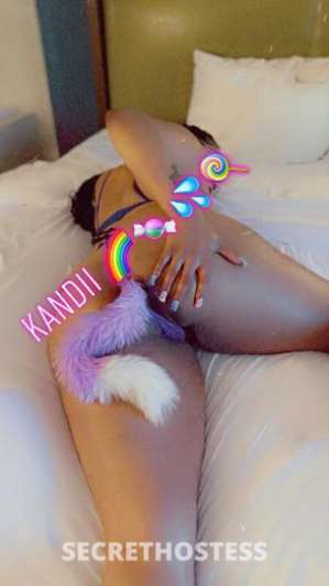 Kandii 26Yrs Old Escort Syracuse NY Image - 2