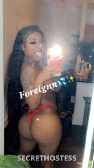 Foreignn 23Yrs Old Escort Worcester MA Image - 2