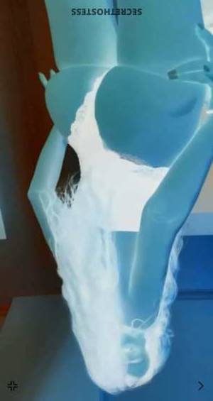 26Yrs Old Escort 175CM Tall Baku Image - 5