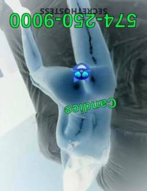 Candice 25Yrs Old Escort Bowling Green KY Image - 3