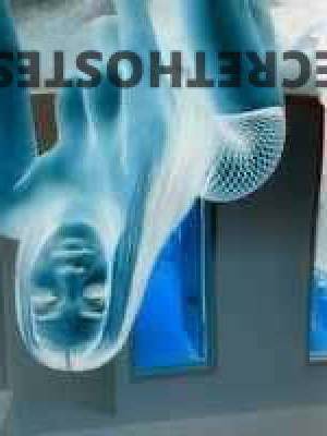 Coco 25Yrs Old Escort Rochester NY Image - 2