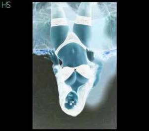 Anna 27Yrs Old Escort Dublin Image - 2