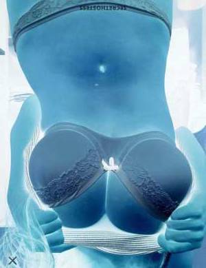 37Yrs Old Escort Westchester FL Image - 1