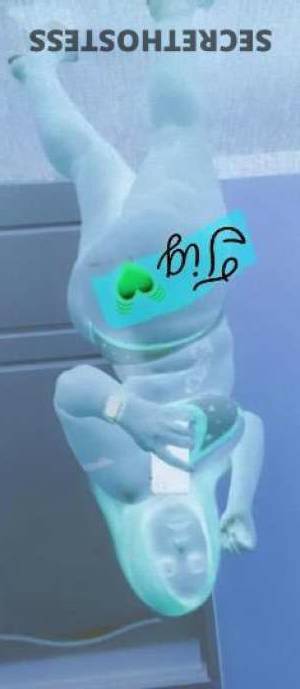 RedSNAPPA 29Yrs Old Escort Montgomery AL Image - 4