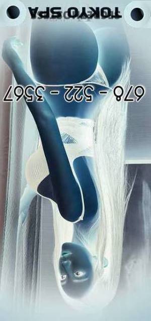 22Yrs Old Escort Atlanta GA Image - 2
