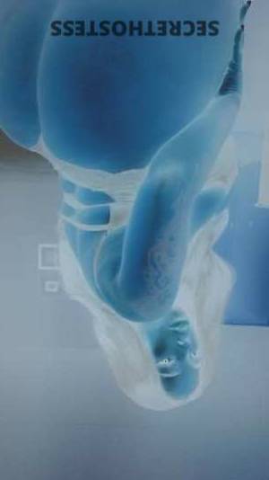 LovelyLyric 26Yrs Old Escort Boston MA Image - 2