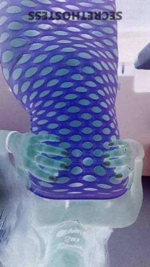 Catalina 22Yrs Old Escort Albany NY Image - 8