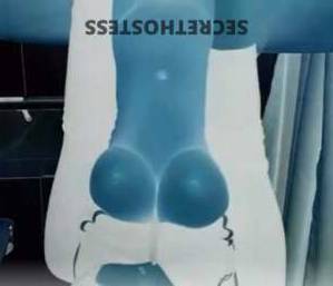 22Yrs Old Escort Adelaide Image - 1
