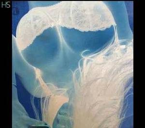 24 year old Brazilian Escort in Rochester Kent Indulge in Pleasure with a Curvy Brazilian Ebony in 