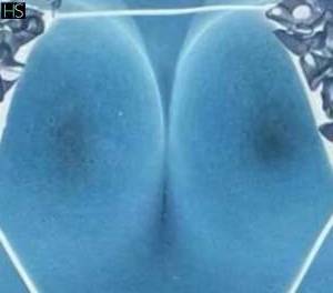 25 year old Latino Escort in Kildare East Coast and Midlands Snapchat Deboh Sexy 25 Year Old Escort Available For Nuru, 