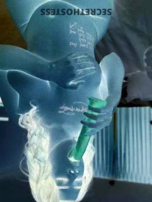 Starbaby 19Yrs Old Escort Visalia CA Image - 5