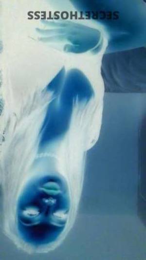 Hazel 22Yrs Old Escort Pueblo CO Image - 6