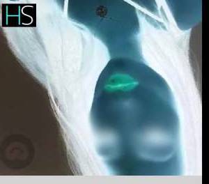 35 year old Irish Escort in Dublin Ultimate Sensual Massage in Dublin with Flirtatious Irish 