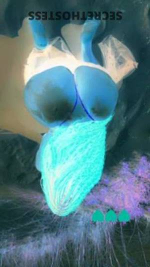 STRAWBERRY 28Yrs Old Escort Baton Rouge LA Image - 5