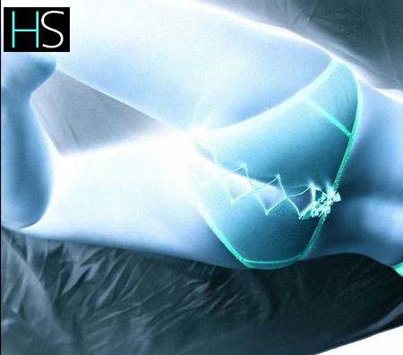 43Yrs Old Escort Size 10 Essex Image - 2