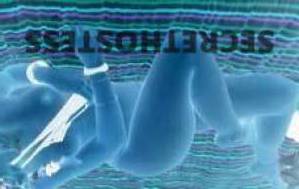 23Yrs Old Escort Brisbane Image - 3