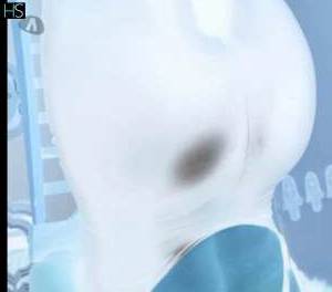 37 year old Escort in Dublin Sexy massage in Rathmines