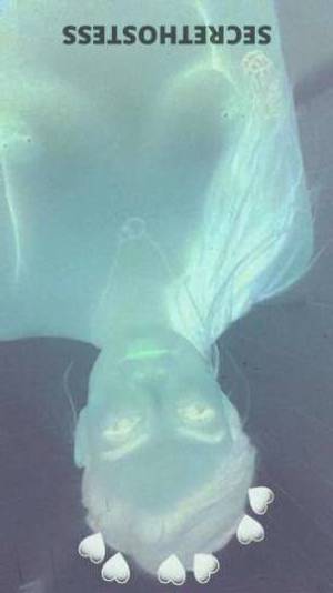 25Yrs Old Escort Chicago IL Image - 1