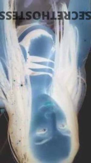 23 year old Australian Escort in Dundas Sydney Erotic Encounters Central Coast & Parramatta