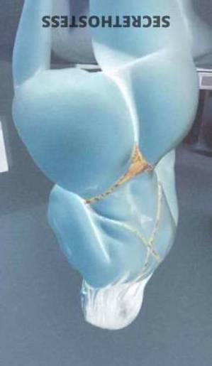 28Yrs Old Escort Treasure Coast FL Image - 1