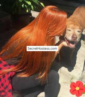 Angel 30Yrs Old Escort 63KG 167CM Tall Yerevan Image - 1