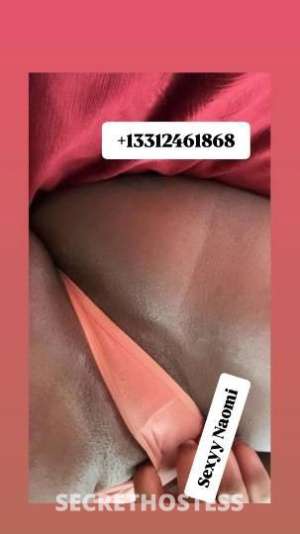 26 year old Escort in Chicago IL INCALL Oakbrook Holiday Inn BEST LIPS 30 DOLLAR HEAD EAT MY 