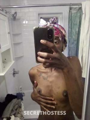 20 year old Escort in Albany NY IM BACKKK!??. lets have fun again