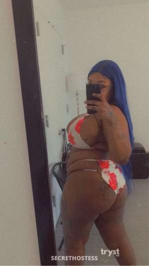 20 year old Trinidadian Escort in Queens NY Beautyy - Exotic Trini Ready 2 Play