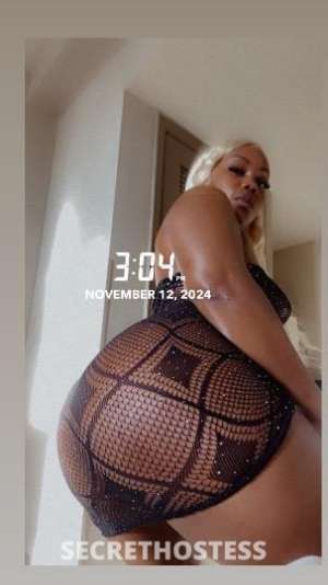 Star 32Yrs Old Escort 157CM Tall Chicago IL Image - 1