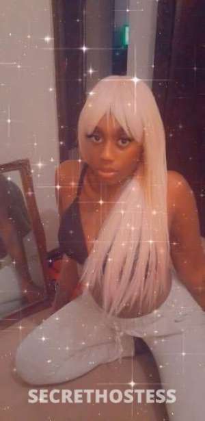 28 year old Escort in Kansas City MO 2Famous!! ⭐8⭐1⭐6⭐6⭐4⭐3⭐1⭐4⭐0⭐2