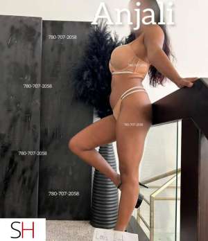 20Yrs Old Escort 157CM Tall Edmonton Image - 3