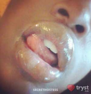 20Yrs Old Escort Buffalo NY Image - 2