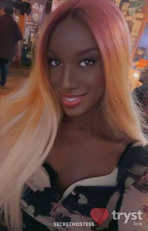 20Yrs Old Escort Boston MA Image - 7