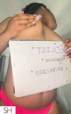 Angel 23Yrs Old Escort Toronto Image - 3