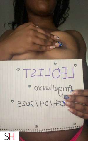 Angel 23Yrs Old Escort Toronto Image - 5
