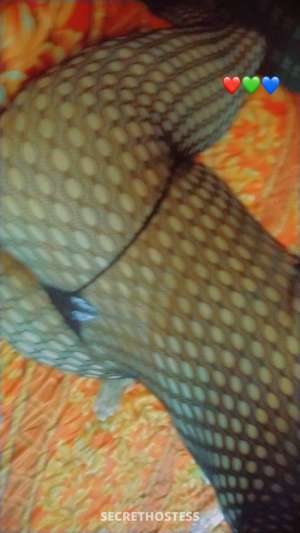 32Yrs Old Escort Bronx NY in Bronx NY